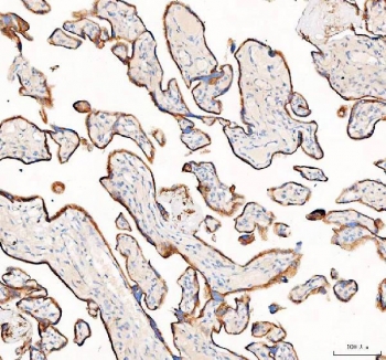 IHC staining of FFPE human placental tissue with 4-Alpha-glucanotransferase antibody. HIER: boil tissue sections in pH8 EDTA for 20 min and allow to cool before testing.