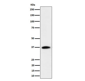 Western blot testing of human Jurkat cell lysate with RASSF2 antibody. Predicted molecular weight ~38 kDa.