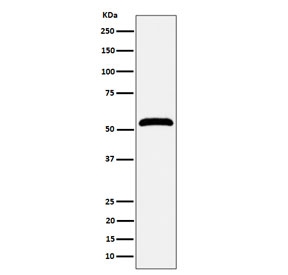 Western blot testing of human Jurkat cell lysate with Membrane Palmitoylated Protein 1 antibody. Expected molecular weight 52-55 kDa.