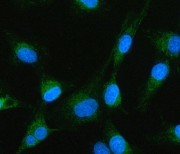 Immunofluorescent staining of FFPE human U-87 MG cells with MTF1 antibody (green) and DAPI nuclear stain (blue). HIER: steam section in pH6 citrate buffer for 20 min.