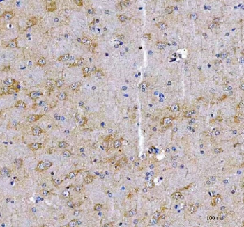 IHC staining of FFPE rat brain tissue with LRRN1 antibody. HIER: boil tissue sections in pH8 EDTA for 20 min and allow to cool before testing.