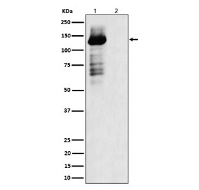 Western blot testing of lysate from 1) human HEK293 cells and 2) human HEK293 cells treated with lambda phosphatase, using phospho-TAOK1/2/3 antibody.