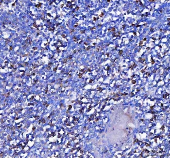 IHC staining of FFPE human tonsil tissue with MZB1 antibody. HIER: boil tissue sections in pH8 EDTA for 20 min and allow to cool before testing.