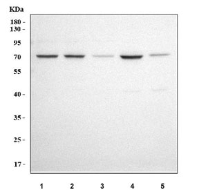 Western blot testing of 1) human K562, 2) human 293T, 3) human SH-SY5Y, 4) human HepG2 and 5) rat brain tissue lysate with IGSF8 antibody. Predicted molecular weight ~65 kDa.