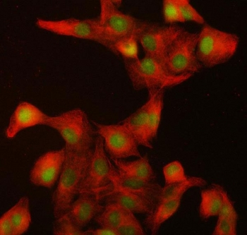 Immunofluorescent staining of FFPE human A549 cells with ILKAP antibody (green) and Beta Tubulin mAb (red). HIER: steam section in pH6 citrate buffer for 20 min.