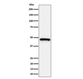 Western blot testing of human HeLa, cell lysate with ING1 antibody. Expected molecular weight ~47 kDa.