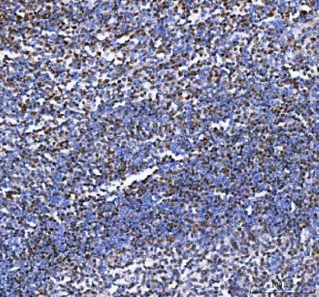 IHC staining of FFPE human tonsil tissue with Aiolos antibody. HIER: boil tissue sections in pH8 EDTA for 20 min and allow to cool before testing.