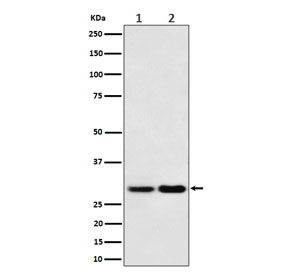 Western blot testing of 1) human 293T and 2) mouse NIH 3T3 cell lysate with MTAP antibody. Expected molecular weight: 26-38 kDa (multiple isoforms).