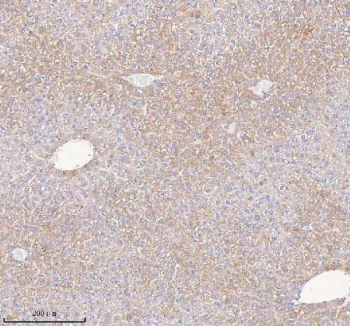 IHC staining of FFPE mouse liver tissue with Hydroxyacid oxidase 1 antibody. HIER: boil tissue sections in pH8 EDTA for 20 min and allow to cool before testing.