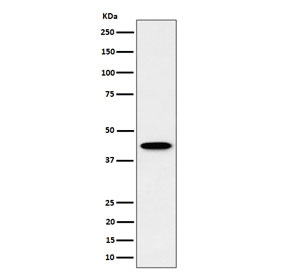 Western blot testing of human HepG2 cell lysate with Inositol-tetrakisphosphate 1-kinase antibody. Predicted molecular weight ~46 kDa.