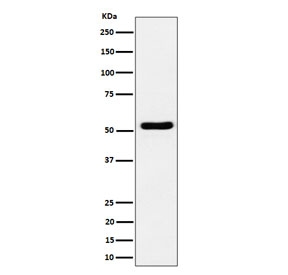 Western blot testing of human Jurkat cell lysate with GPRC5B antibody. Predicted molecular weight ~45 kDa but may be observed at higher molecular weights due to glycosylation.