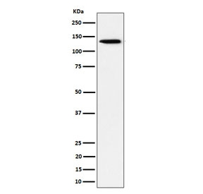 Western blot testing of human HeLa cell lysate with recombinant TRIM24 antibody. Expected molecular weight: 117-140 kDa.