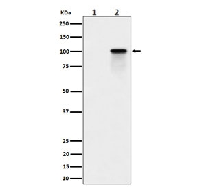 Western blot testing of lysate from human K562 cells, untreated (1) and Calyculin A treated (2), with Phospho-Nucleolin antibody.