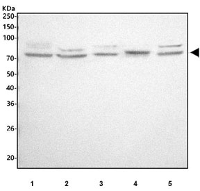 Western blot testing of 1) human A549, 2) human MCF7, 3) human Jurkat, 4) rat RH35 and 5) mouse RAW264.7 cell lysate with ALOX12 antibody. Predicted molecular weight ~76 kDa.