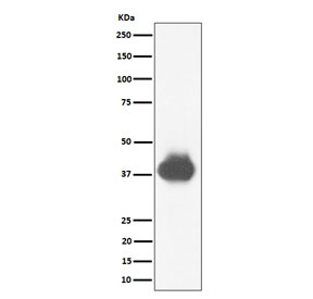 Western blot testing of human U937 cell lysate with CD32A/B/C antibody. Predicted molecular weight: 34-40 kDa depending on level of glycosylation.
