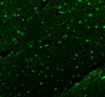 Immunofluorescent staining of FFPE rat brain tissue with Islet 1 antibody (green). HIER: steam section in pH8 EDTA buffer for 20 min.