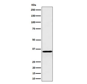 Western blot testing of human HepG2 cell lysate with Pyrophosphatase 1 antibody. Predicted molecular weight ~33 kDa.