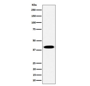 Western blot testing of human Raji cell lysate with PLEK antibody. Predicted molecular weight ~40 kDa.