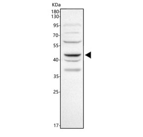 Western blot testing of human SiHa cell lysate with WNT5A antibody. Predicted molecular weight ~41 kDa, commonly observed at 41-45 kDa.