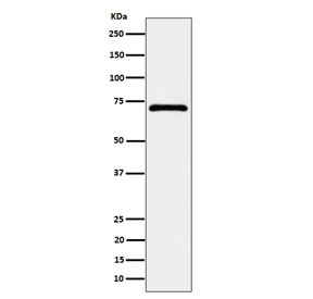 Western blot testing of human MCF7 cell lysate with Epoxide hydrolase 2 antibody. Predicted molecular weight ~63 kDa.