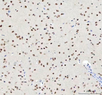 IHC staining of FFPE mouse brain tissue with TARDBP antibody. HIER: boil tissue sections in pH8 EDTA for 20 min and allow to cool before testing.