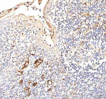 IHC staining of FFPE human tonsil tissue with Plakophilin 2 antibody. HIER: boil tissue sections in pH8 EDTA for 20 min and allow to cool before testing.