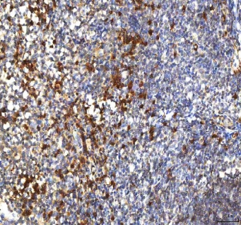 IHC staining of FFPE human tonsil tissue with PCPE1 antibody. HIER: boil tissue sections in pH8 EDTA for 20 min and allow to cool before testing.