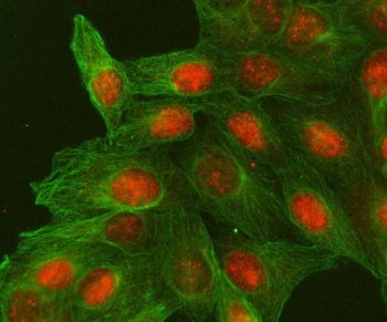 Immunofluorescent staining of FFPE human U-2 OS cells with MACROH2A2 antibody (red) and Beta Tubulin mAb (green). HIER: steam section in pH6 citrate buffer for 20 min.