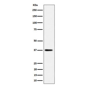 Western blot testing of human HepG2 cell lysate with MRPS31 antibody. Predicted molecular weight ~45 kDa, commonly observed at ~38 kDa.