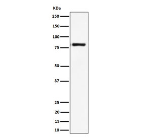 Western blot testing of human Raji cell lysate with LTK antibody. Predicted molecular weight: ~92 kDa, ~86 kDa, ~79 kDa and additional smaller isoforms.