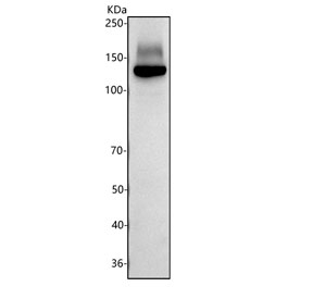 Western blot testing of human HeLa cell lysate with JAG2 antibody. Predicted molecular weight ~133 kDa, may be observed at higher molecular weights due to glycosylation.