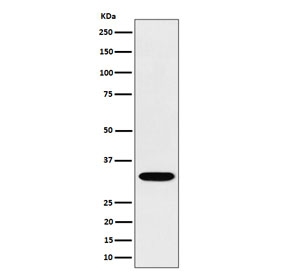 Western blot testing of human Jurkat cell lysate with TSFM antibody. Predicted molecular weight ~35 kDa.