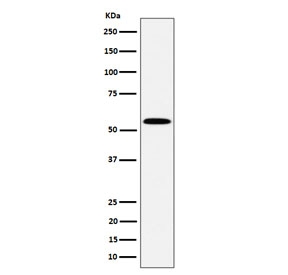 Western blot testing of human Jurkat cell lysate with PNKP antibody. Predicted molecular weight ~57 kDa.
