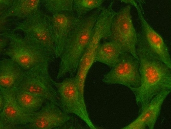 Immunofluorescent staining of FFPE human A549 cells with CENP-R antibody (red) and Beta Tubulin mAb (green). HIER: steam section in pH6 citrate buffer for 20 min.