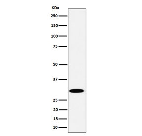 Western blot testing of human Jurkat cell lysate with Thiopurine methyltransferase antibody. Predicted molecular weight ~28 kDa.