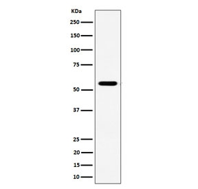 Western blot testing of human Jurkat cell lysate with RNF14 antibody. Predicted molecular weight ~54 kDa.