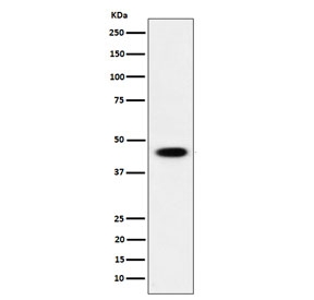 Western blot testing of human HEK293 cell lysate wit ADSS2 antibody. Predicted molecular weight ~50 KDa.