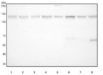 Western blot testing of 1) human HeLa, 2) human SH-SY5Y, 3) human U-2 OS, 4) rat brain, 5) rat C6, 7) mouse brain and 8) mouse Neuro-2a cell lysate with CYFIP1 antibody. Predicted molecular weight ~145 kDa but multiple smaller isoforms.