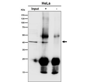 Immunoprecipitation of ACAT1 protein from 500ug of human K562 whole cell lysate with ACAT1 antibody at 1:50. Western blot testing was done at 1:1000.