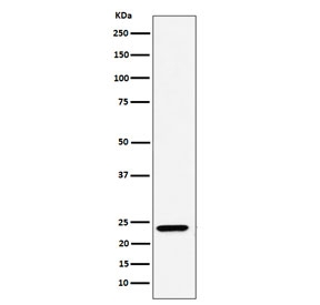 Western blot testing of human A549 cell lysate with DNAJC12 antibody. Predicted molecular weight ~23 kDa.