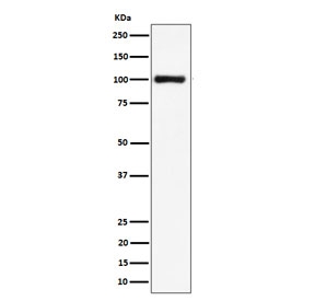 Western blot testing of human HeLa cell lysate with NCL antibody. Predicted molecular weight ~77 kDa, commonly observed at 100~110 kDa.