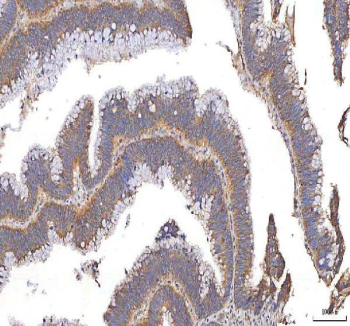 IHC staining of FFPE human colon tissue with XDH antibody. HIER: boil tissue sections in pH8 EDTA for 20 min and allow to cool before testing.