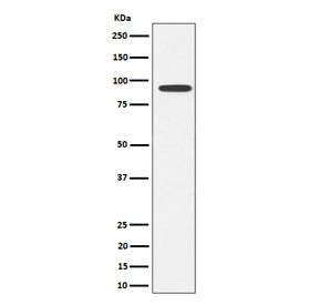 Western blot testing of human SH-SY5Y cell lysate with GlyT2 antibody. Predicted molecular weight ~87 kDa.