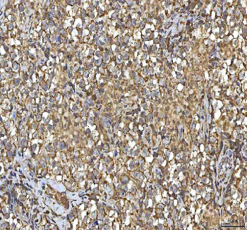 IHC staining of FFPE human testicular seminoma tissue with SMIM8 antibody. HIER: boil tissue sections in pH8 EDTA for 20 min and allow to cool before testing.