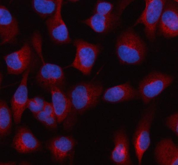 Immunofluorescent staining of FFPE human HeLa cells with HDLBP antibody (red) and DAPI nuclear stain (blue). HIER: steam section in pH6 citrate buffer for 20 min.
