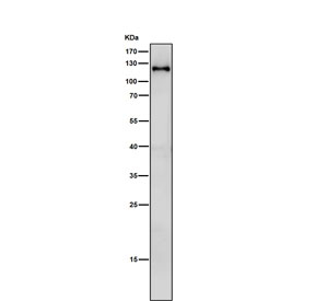 Western blot testing of mouse lung tissue lysate with SPINK5 antibody. Predicted molecular weight ~121 kDa.