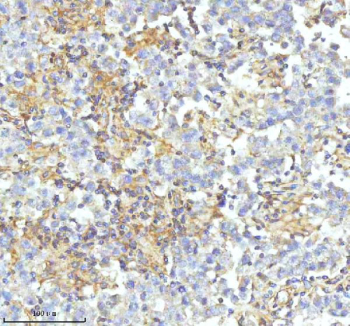IHC staining of FFPE human testicular seminoma tissue with HDHD2 antibody. HIER: boil tissue sections in pH8 EDTA for 20 min and allow to cool before testing.