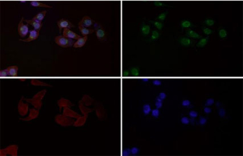 Immunofluorescent staining of FFPE human HeLa cells with Phospho-HSF1 antibody (green), Phalloidin (red) and DAPI nuclear stain (blue). HIER: steam section in pH6 citrate buffer for 20 min.