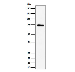Western blot testing of human 293T cell lysate with RAVER2 antibody. Predicted molecular weight ~74 kDa.