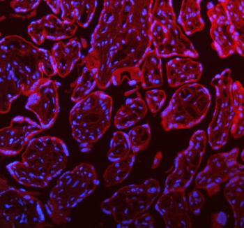 Immunofluorescent staining of FFPE human placental tissue with STIM1 antibody (red) and DAPI nuclear stain (blue). HIER: steam section in pH8 EDTA buffer for 20 min.